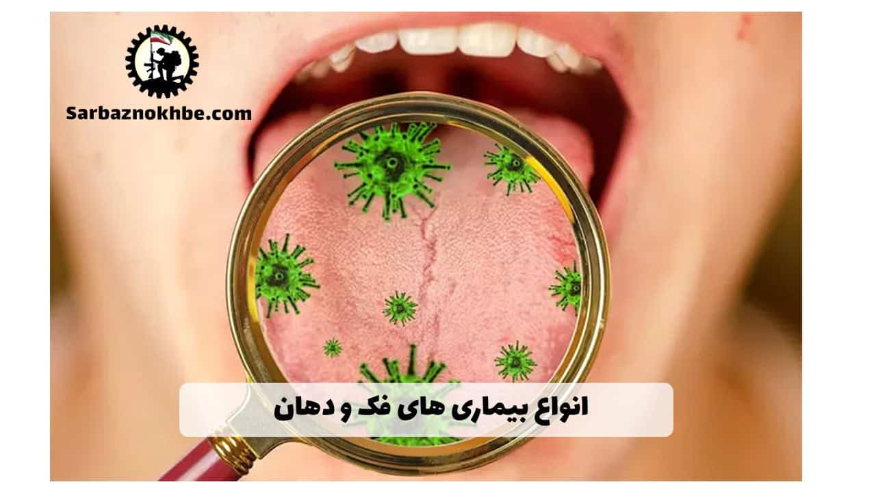 بیماری‌های فک، دهان و دندان